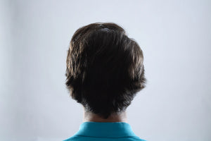 Understanding Hair Loss Causes and Treatments Unveiled
